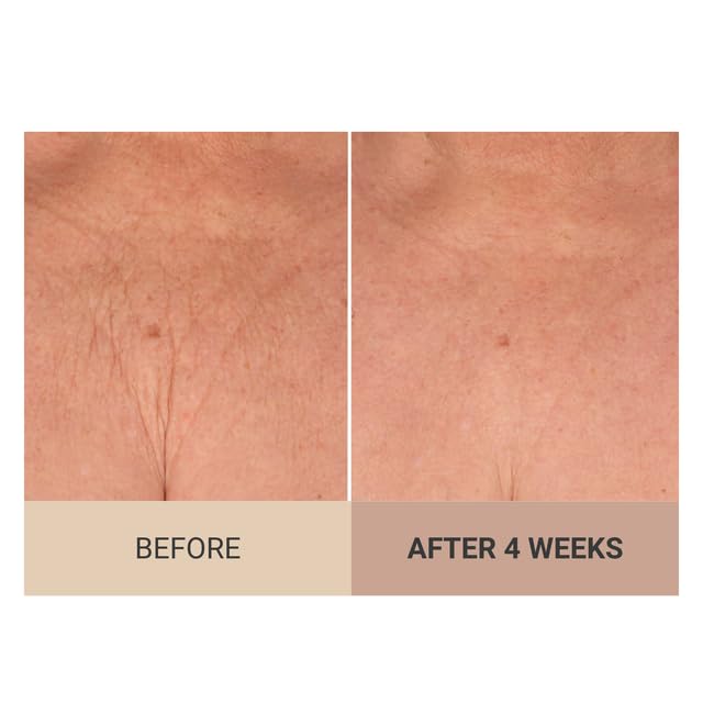 Consult Beaute Champagne Lift Hydrating Firming Body Cream - Image 6