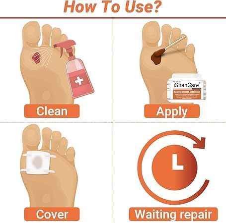 iShanCare® Diabetic Wound Ulcer Cream - Image 6