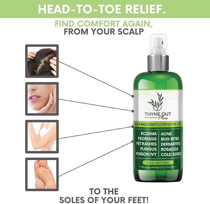 Plus Eczema Treatment, Psoriasis Treatment Treats Acne, Dermatitis, Cold Sores - Image 8