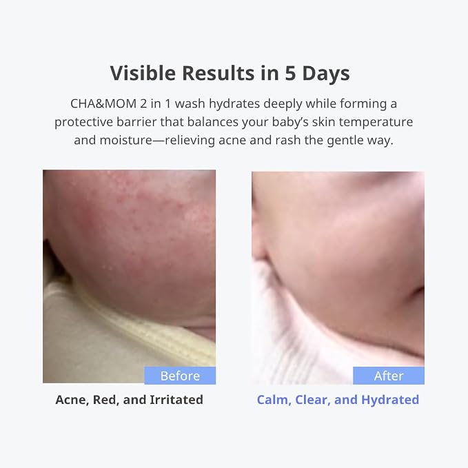 Cha&Mom Head-to-toe Korean Baby Skincare - Image 2