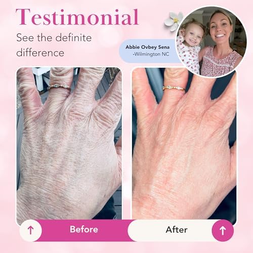 Theraplex Clear Emollient Lotion - Image 4