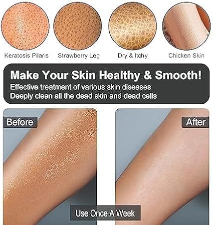 Yiclick Exfoliating Gloves, Body Scrub Exfoliator - Image 4