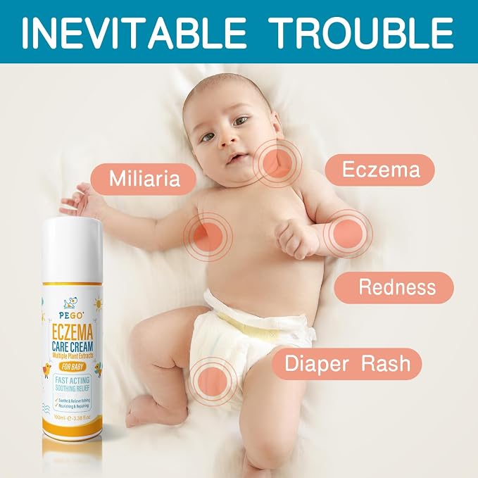 Baby Eczema Cream - Image 7