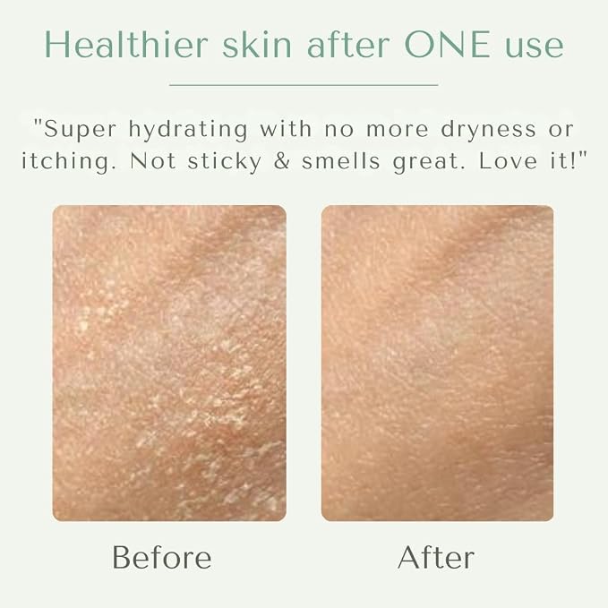 Yobee Body & Face Moisturizing Cream - Image 10
