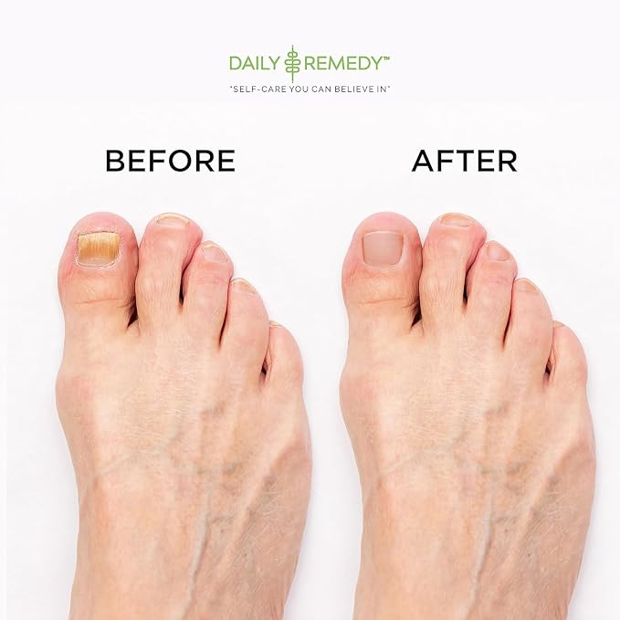 EXTRA STRENGTH Tea Tree Oil Foot Soak - Image 5