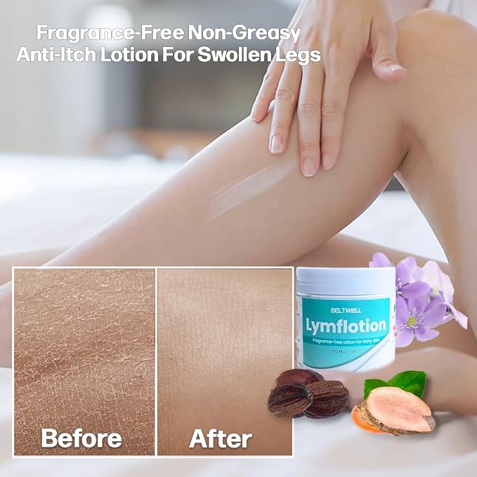 Beltwell® Lymflotion Non-Greasy Moisturizer - Image 6