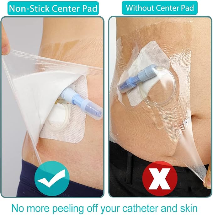 25 Pcs Waterproof PD Dialysis Catheter Wound Cover Shields Island Dressing - Image 4