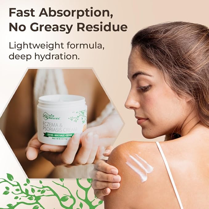 Wild Naturals Eczema & Psoriasis Cream - Image 2