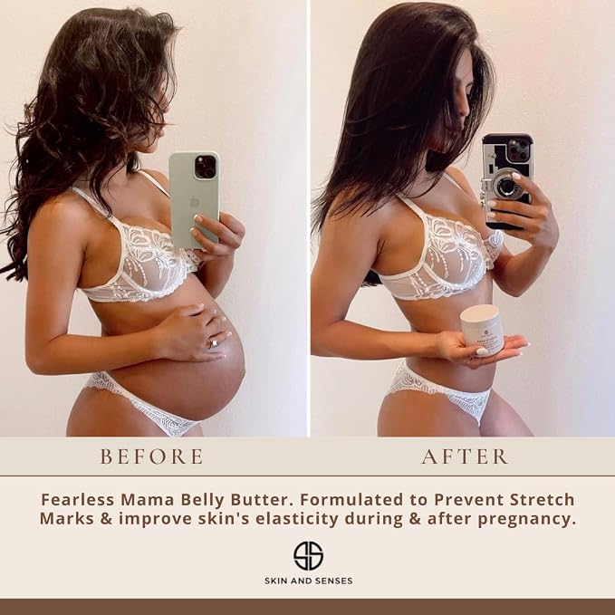 Fearless Mama Belly Butter – Unscented Stretch Mark Cream - Image 4