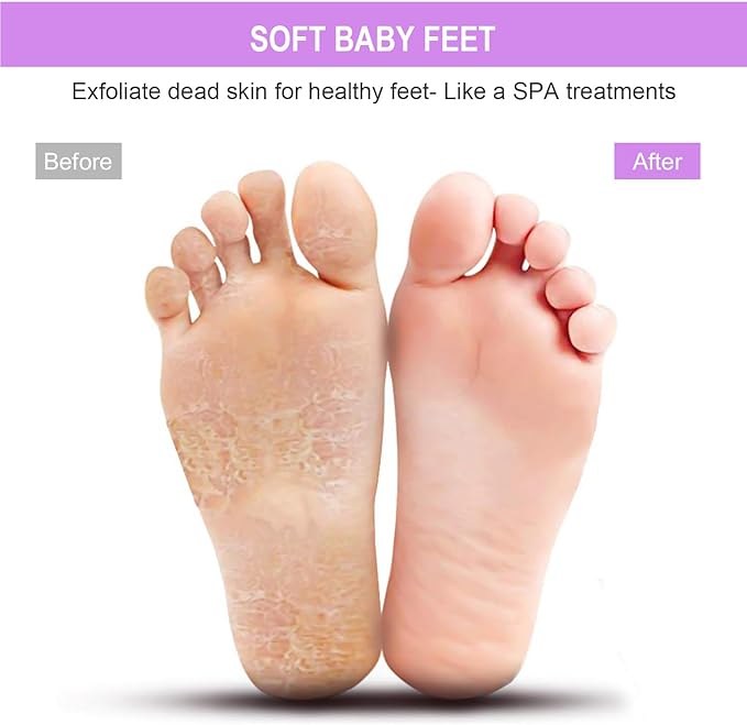BESKAR XL Large Foot Scrubber Mat - Image 4