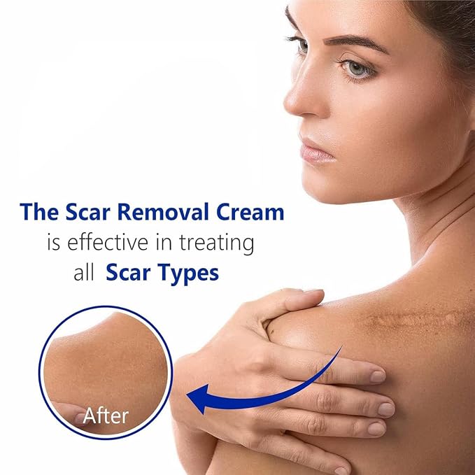 Advanced Scar Gel for Surgical Scars, Stretch Marks, Keloids - Image 5