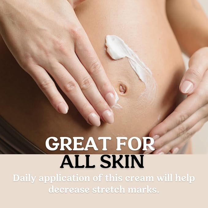 Roe Wellness Stretch Mark Cream - Image 4
