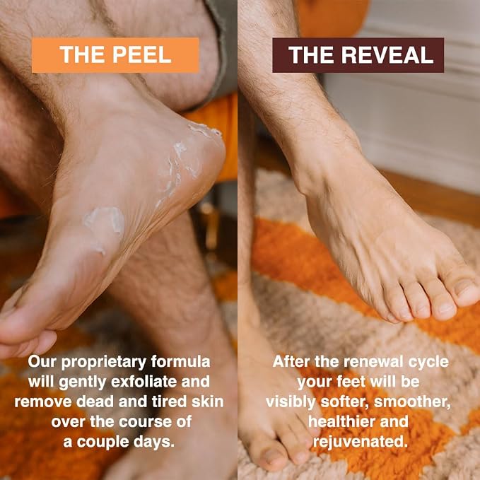 FEETS Foot Peel Mask with Eucalyptus and Lavender | Remove and Exfoliate Dead - Image 4