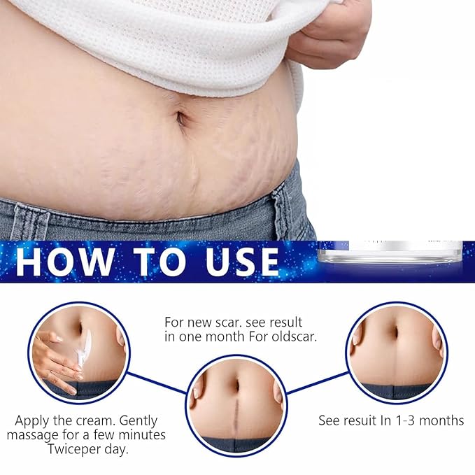 Advanced Scar Gel for Surgical Scars, Stretch Marks, Keloids - Image 4