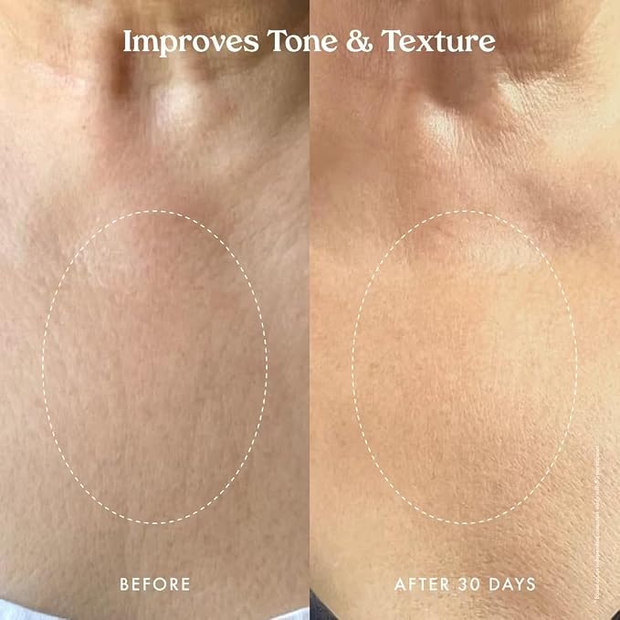 Kopari Ultra Restore Firming Body Serum - Image 4