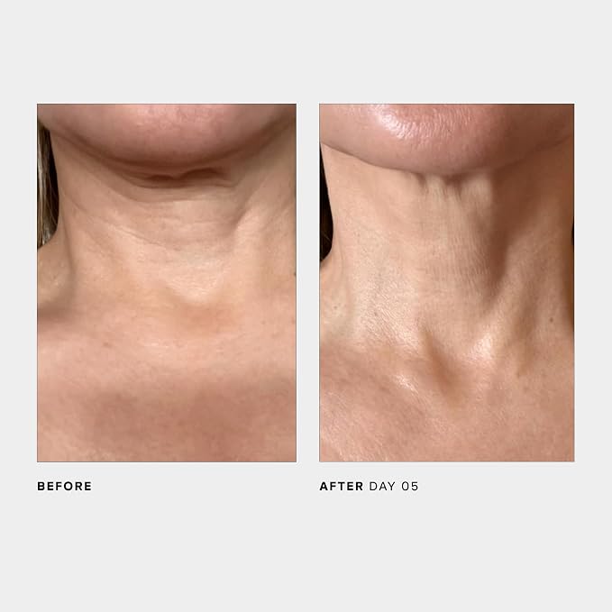 U Beauty The SCULPT Neck + Décolleté Concentrate - Image 7