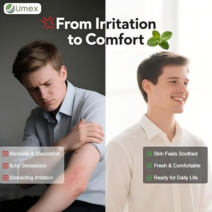 Umex Intensive Itch Relief Cream - Image 5