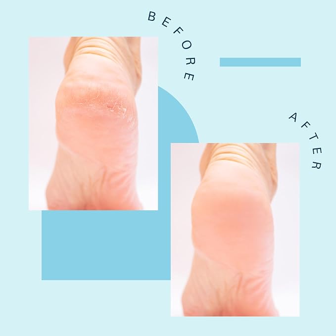Tea Tree Oil Foot Soak and Epsom Salts - Image 8