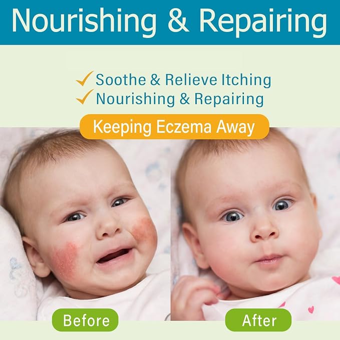 Baby Eczema Cream - Image 2