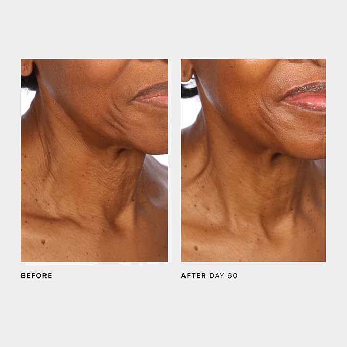 U Beauty The SCULPT Neck + Décolleté Concentrate - Image 8