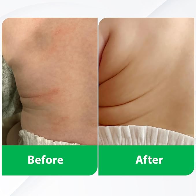 Manuka Honey Cream - Image 7