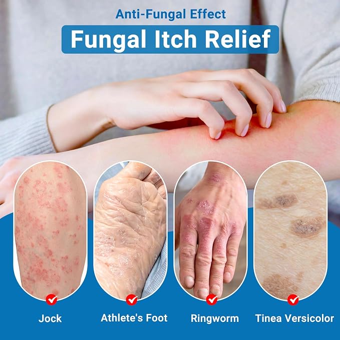 ishancare Anti Itch Cream Extra Strength, Oatmeal Soothing Skin Itch Relief - Image 4