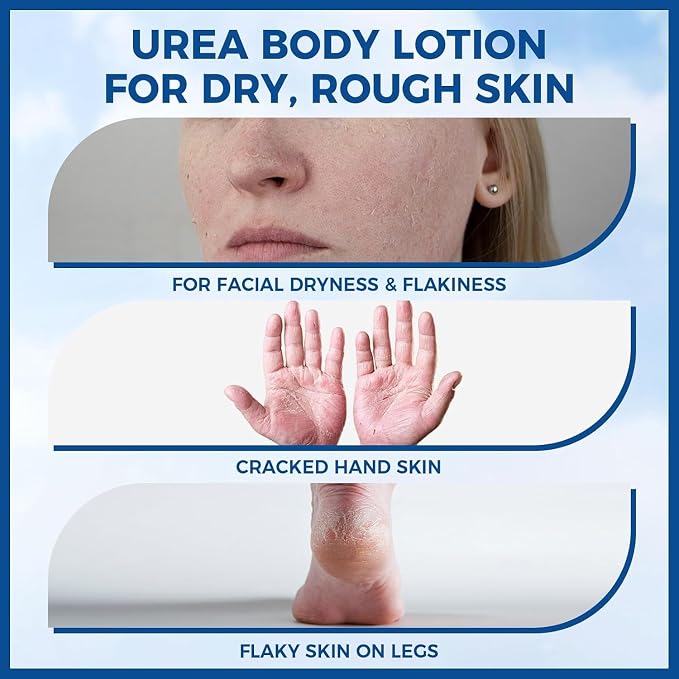 40% Urea Foot Cream with 2% Salicylic Acid, Urea Cream 40 Percent - Image 2
