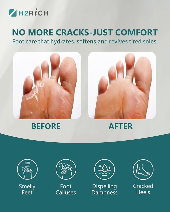 Hydrogen Foot Soak Effervescent Tablets 2 Pieces | Ginger & Mugwort Herb Foot - Image 4