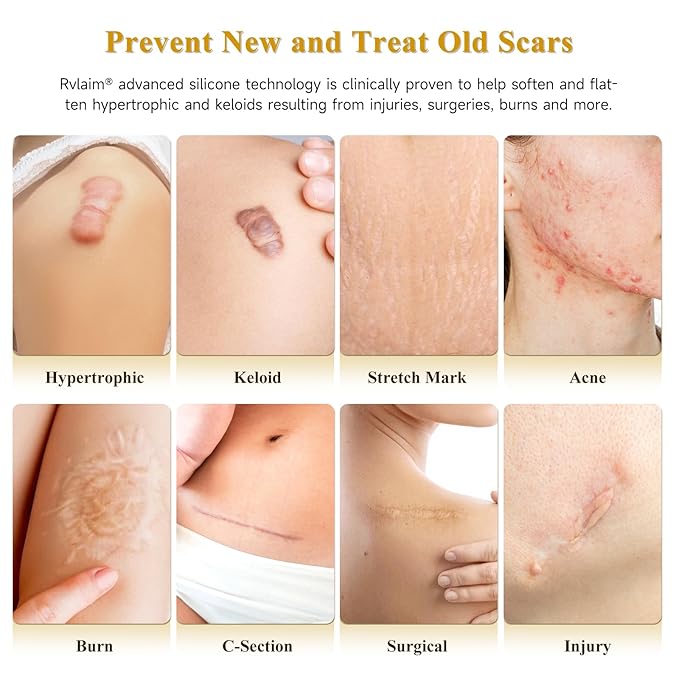 Silicone Scar Cream Scar Gel, Advanced Scar Cream - Image 2