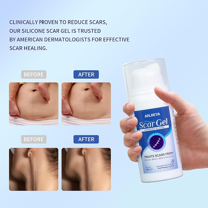 Silicone Scar Gel, Advanced Scar Cream - Image 4