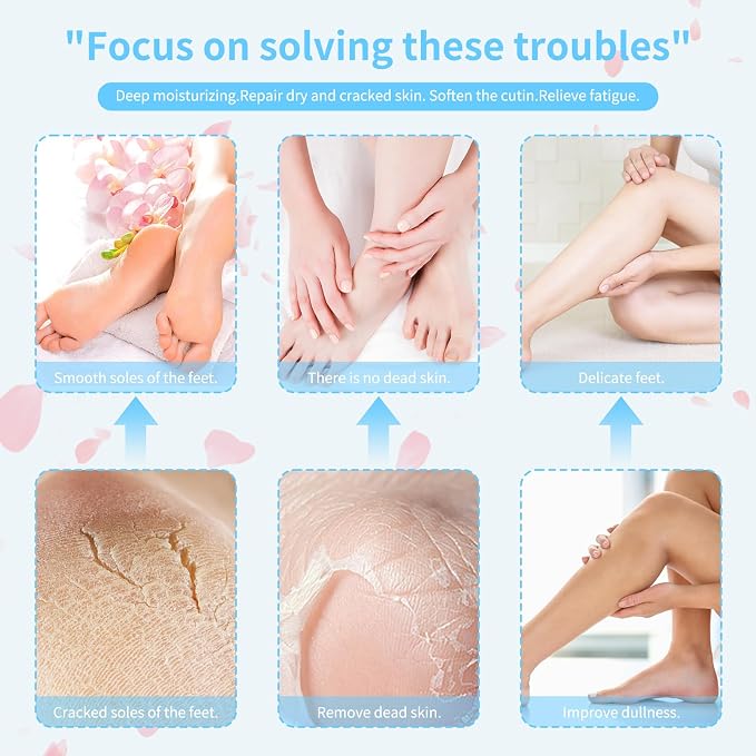 Gel Socks for Dry Cracked Feet Women, Foot Moisturizing Socks, Gel Socks Spa - Image 3