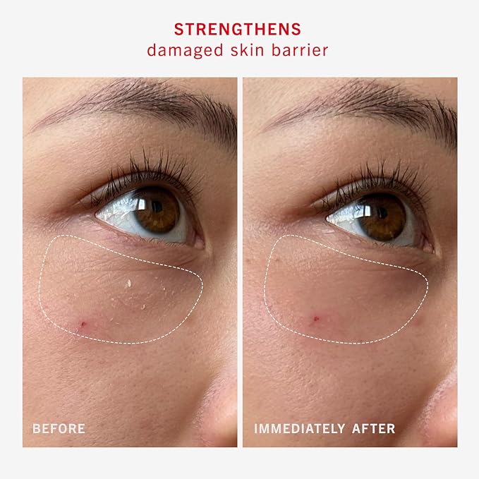 First Aid Beauty - Image 6