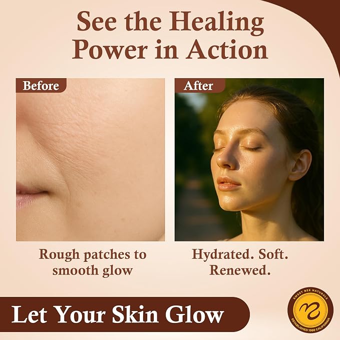 Sweet Bee Magic All In One Healing Organic Balm - Image 7