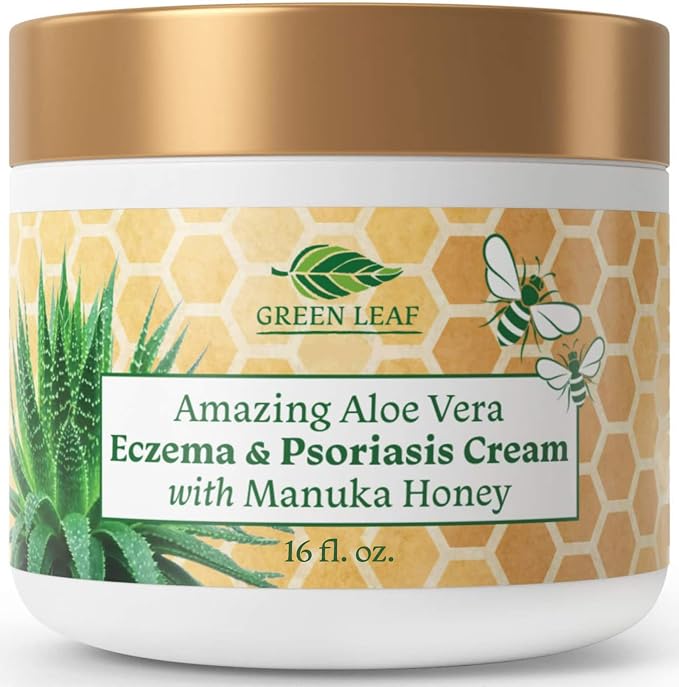 Manuka Honey Eczema Cream Moisturizing Lotion by AmazingAloeVerabyGLN