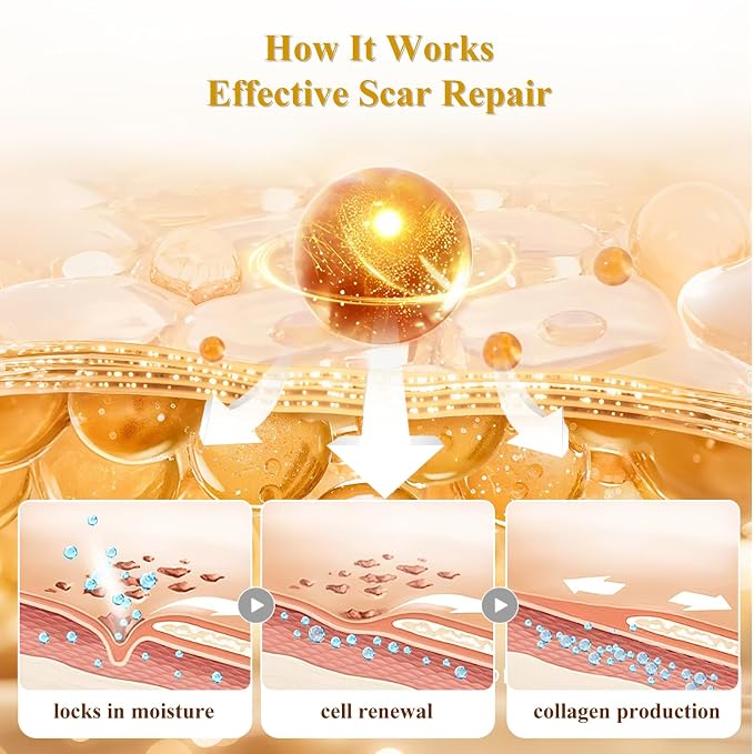 Silicone Scar Cream Scar Gel, Advanced Scar Cream - Image 5