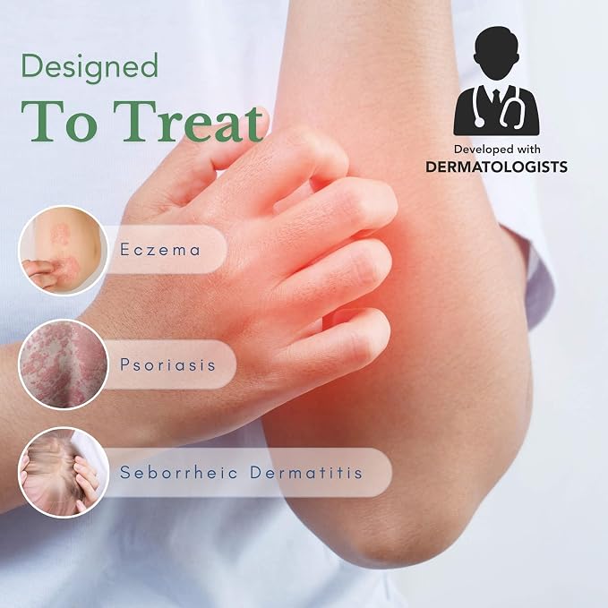 Theraplex AIM - Anti Itch Cream – 1% hydrocortisone - Image 2