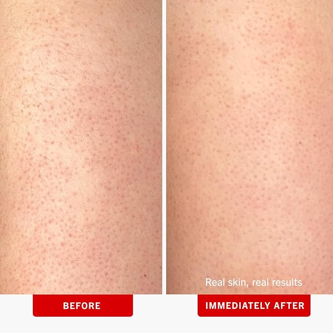 First Aid Beauty - Image 3