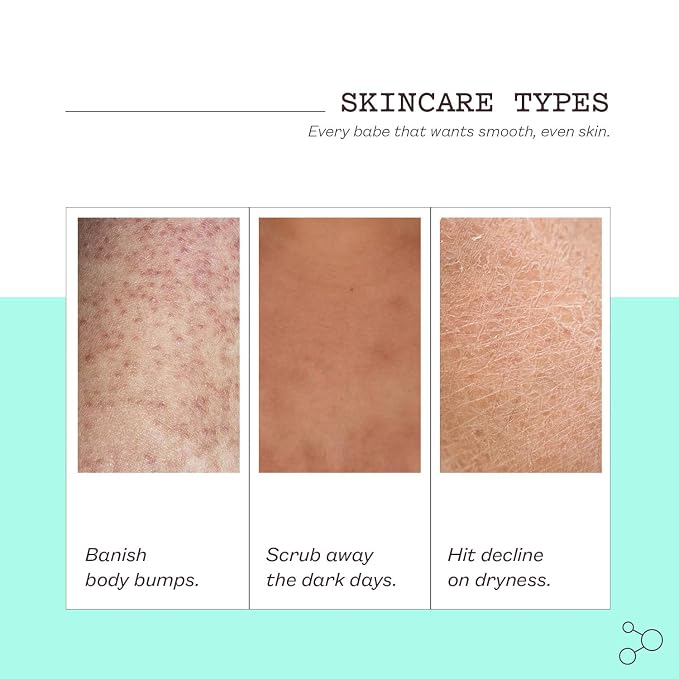 frank body Glycolic Acid Body Scrub | Fights KP & Breakouts, Spots & Tighten - Image 4
