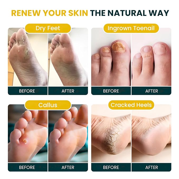 FOOT CURE Citrus Detox Foot Soak - Image 3