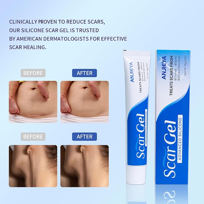Silicone Scar Gel Advanced Scar Cream - Image 4