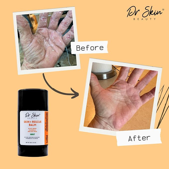 Dr. Skin Mint Rescue Balm - Image 4