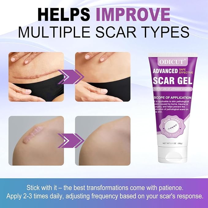 Silicone Scar Gel, Intensive Scar Cream, 2.1oz Keloid Bump Removal - Image 5