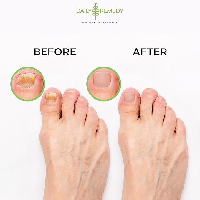 Tea Tree Oil Foot Soak with Epsom Salt - Image 6