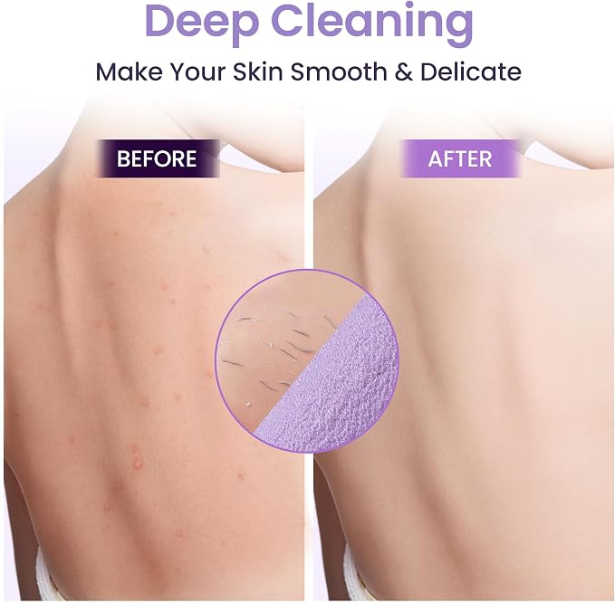 3 Pcs Double-Sided Back Exfoliator Body Scrub Towel, Exfoliating Back Scrubber - Image 4