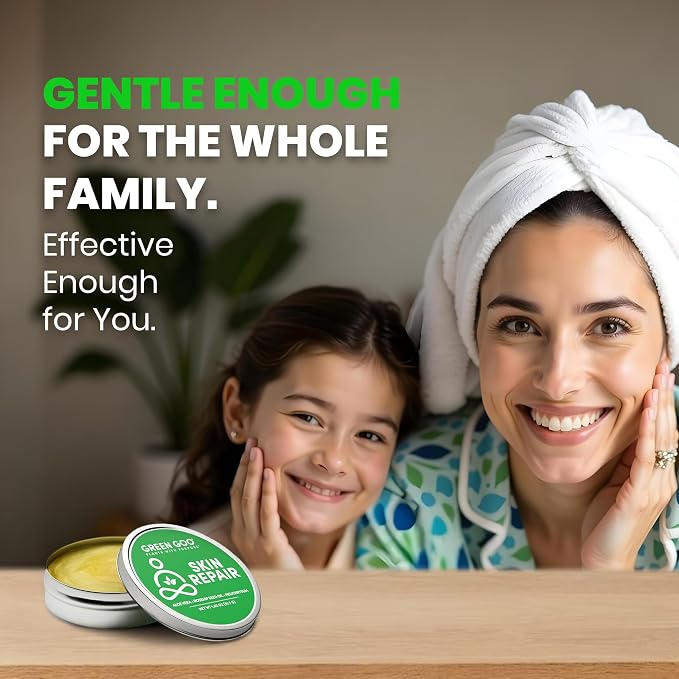 Green Goo Natural Skin Care Salve, Skin Repair and Protection, 1.82-Ounce Large - Image 3