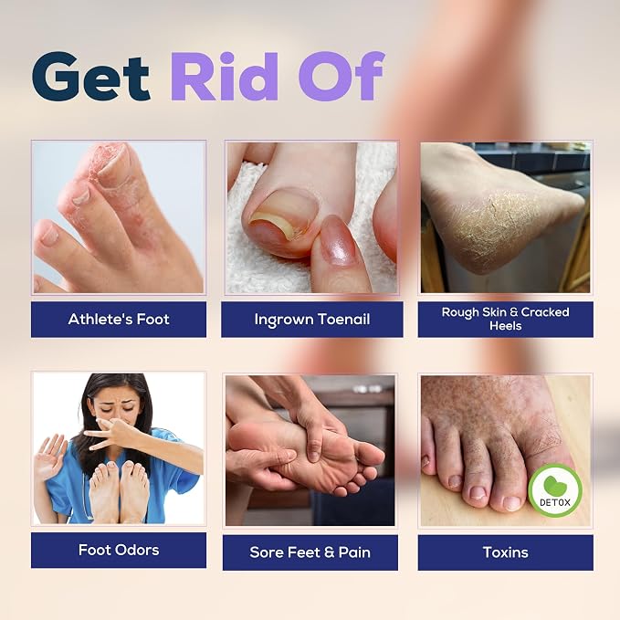 FOOT CURE Premium Epsom Salt Foot Soak - Image 6