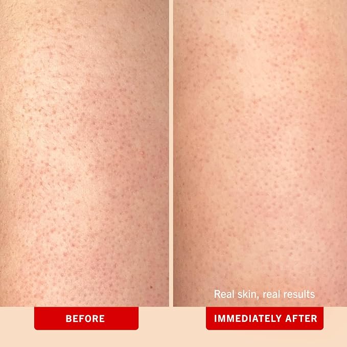 First Aid Beauty - Image 3