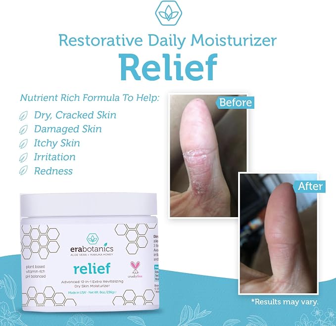Era Organics Eczema, Psoriasis & Dermatitis Moisturizer Cream - Image 5