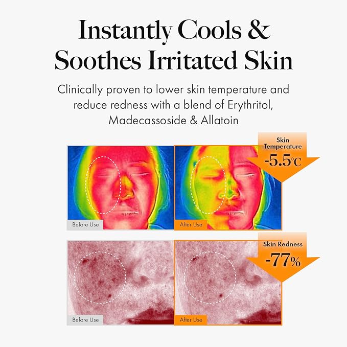 MASTINA Mastic Face Spray Facial Mist - Image 3