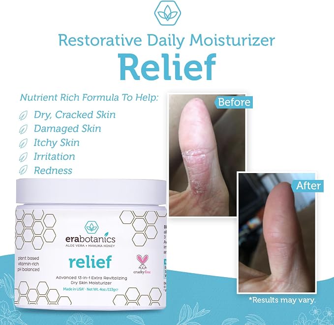Era Organics Eczema, Psoriasis & Dermatitis Moisturizer Cream - Image 5